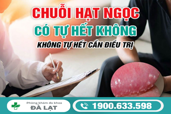Hình ảnh minh họa